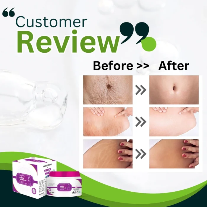 Stretch mark removal cream